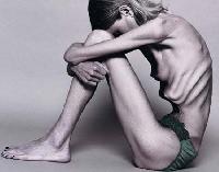 Despre anorexie: cauze, simptome, tratament